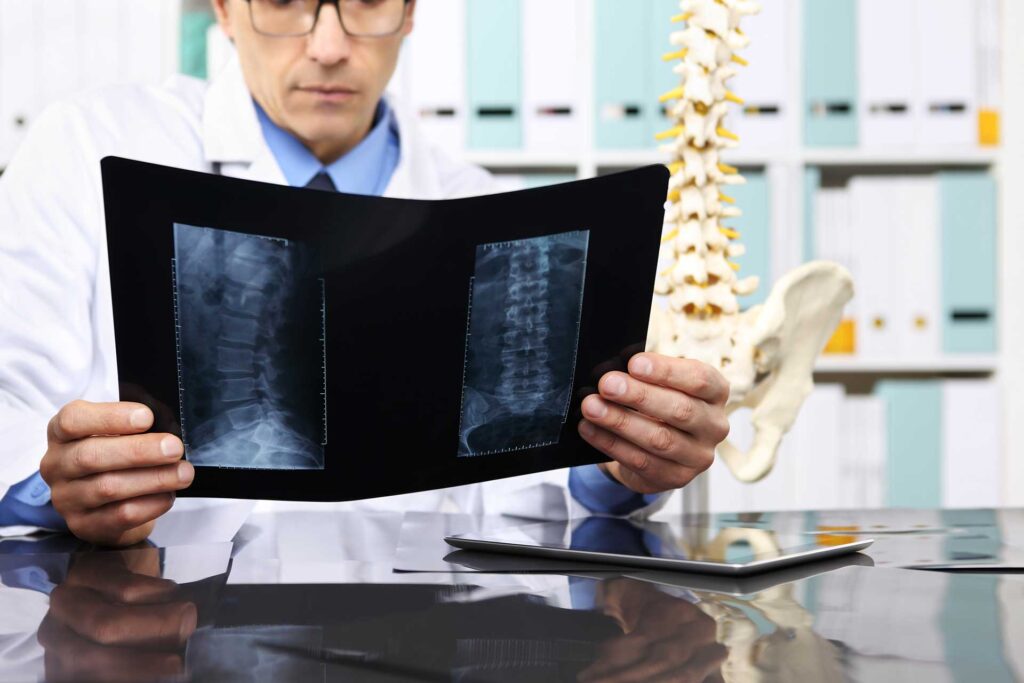 chiropractor checking x-ray of spine